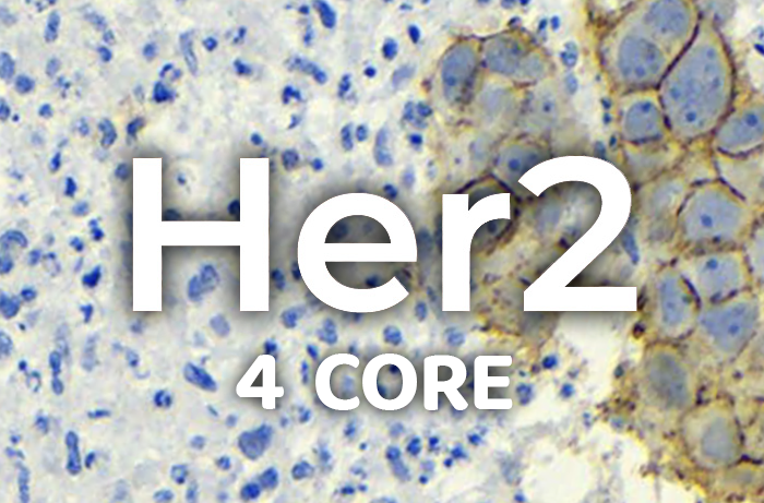 Her2/Neu 4 Core Controls